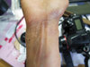 20190607myarm.jpg